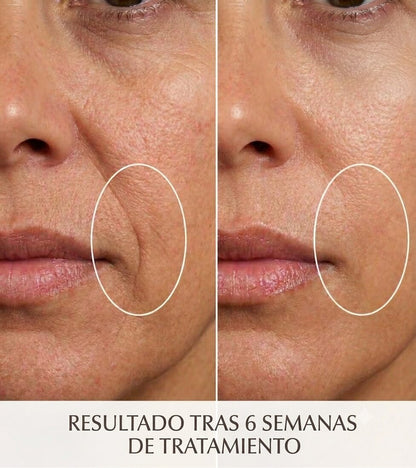 Mascarilla LED Nucarna - resultados visibles en la piel tras 6 semanas de uso